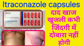 Itraconazole capsules 200 mg  itraconazole capsules 100mg  itraconazole capsules uses in hindi [upl. by Griffiths]