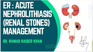 RENAL STONES  ER ACUTE MANAGEMENT NEPHROLITHIASIScasestudy emergency education [upl. by Kasey]