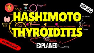 HASHIMOTO THYROIDITIS Pathogenesis Clinical Symptoms Treatment [upl. by Aligna]