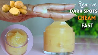 Best homemade cream for dark spots  Dark Spots Removal Cream [upl. by Chet984]