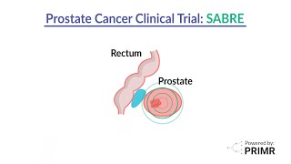 Prostate Cancer Clinical Trial SABRE Trial [upl. by Jt145]