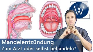 Mandelentzündung amp Halsschmerzen Schnell loswerden amp Was Sie wissen müssen wenn Sie betroffen sind [upl. by Eskill]