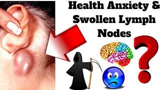 Health Anxiety amp Swollen Lymph Nodes [upl. by Aneda84]