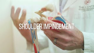 Shoulder Impingement Causes and Treatment [upl. by Atikaj]