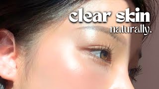 How I Cleared My Skin In 8 Weeks naturally [upl. by Eednyl70]