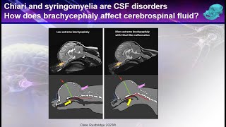 Syringomyelia from the expert  the filling mechanism [upl. by Ob]