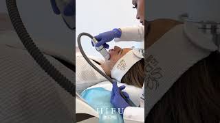 Revolutionary HIFU Face Lifting Treatment at EDEN AESTHETICS Clinic  NonSurgical Skin Tightening [upl. by Atteram]