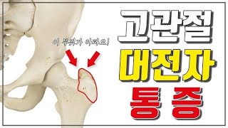 엉덩이 통증 고관절 점액낭염 초음파검사 PDRN 주사치료 Greater Trochanteric Bursitis Treatment with PDRN Injection [upl. by Inhoj]