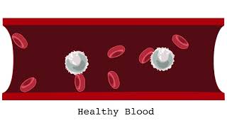 What is acute leukemia [upl. by Asilrac]