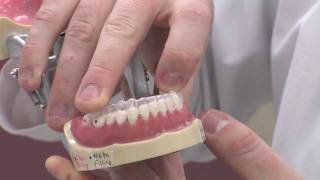 Dental Health amp Information  Pros amp Cons of Invisalign Braces [upl. by Jaclin]