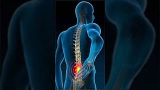 કમરના મણકાની તકલીફ Lumbar Spondylosis and Lumbar IV Disc Herniation માં મળેલ પરિણામ [upl. by Lilaj]