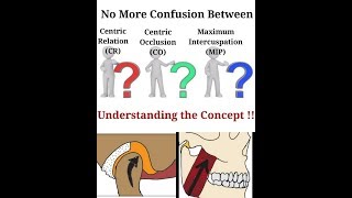 Understanding the Concept of Centric Relation Centric Occlusion Maximum Intercuspation [upl. by Nit]