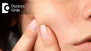 What can cause painful lump on cheek  Dr Srivats Bharadwaj [upl. by Namlaz]