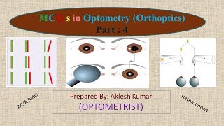 MCQ in Optometry Orthoptics part 4 [upl. by Aratehs31]