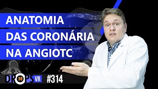 ANATOMIA DAS CORONÁRIAS NA ANGIOTC [upl. by Awad]