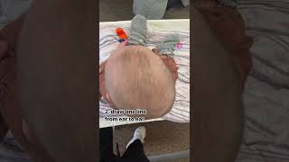 How to Check Your Baby’s Head for a Flat Spot babyshorts torticollis plagiocephaly helmet [upl. by Bogie]