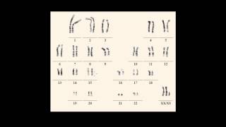 Karyotype notations [upl. by Tomlin]