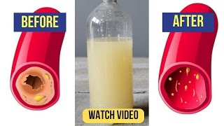 Only a Glass of This Juice will Remove Clogged Arteries And Control Blood Pressure [upl. by Notnyw]