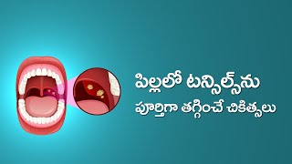 Causes and Cures for Tonsillitis and Adenoiditis in Children in Telugu  టాన్సిల్స్ వాపు [upl. by Eelannej]