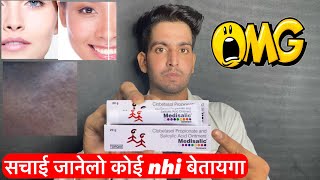 Medisalic cream  Medisalic cream kaise lagaye  Medisalic cream side effects  medisalic cream use [upl. by Leirraj84]