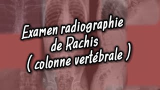 Radiographie de rachis ou de la colonne vertébrale ☢️ Partie 01 ⏩ [upl. by Nosylla]