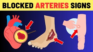 7 Warning Signs of Blocked Heart Arteries In Legs and Feet Dont Ignore These Signals  VisitJoy [upl. by Aaberg]