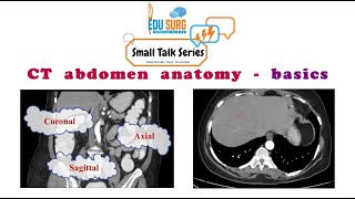 CT Abdomen anatomy  Radiology lectures  small talk series  Edusurg clinics [upl. by Varini]