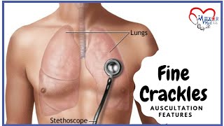 Fine Crackles  Lung Sounds  Auscultation Features [upl. by Keheley]