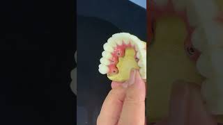 Dental Implant Crown [upl. by Woodhead889]