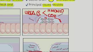 Mapas Mentales Gastroenterología ENAMENARMSERUMS [upl. by Eliot]