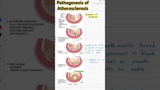 Pathogenesis of Atherosclerosispathology atherosclerosis [upl. by Adorne]