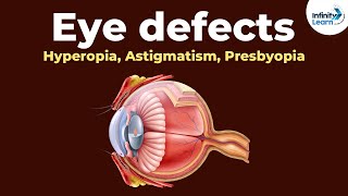 Eye defects  Hyperopia Astigmatism Presbyopia  Dont Memorise [upl. by Nad506]