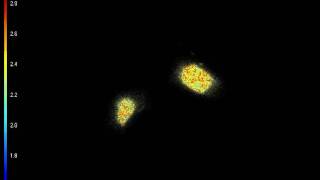 YFPTransfected Cells Fluorescence Lifetime Spinning Disk [upl. by Saffren]