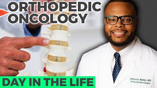 Day In The Life of Orthopedic Oncology [upl. by Anrym]