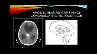 Cerebrospinal fluid [upl. by Sanalda]