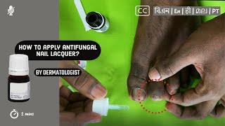 💅 How to apply antifungal nail lacquer to nail fungus  by Dermatologist [upl. by Yruok]