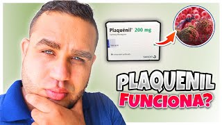 PLAQUENIL Hidroxicloroquina 200 mg PARA QUE SIRVE  EFECTOS SECUNDARIOS  EMBARAZO  LUPUS [upl. by Blandina715]