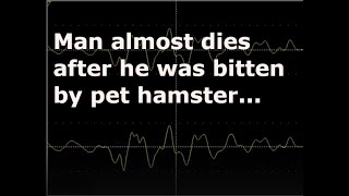 Nathan Halliday was almost killed by his own pet hamster after it bit him [upl. by Fineman961]