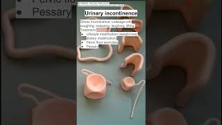 Urinary incontinence [upl. by Duthie705]