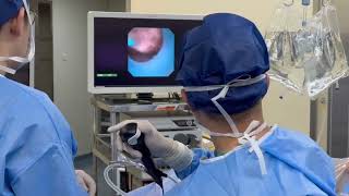 Clinical Application Of Geyi Endoscope Camera System [upl. by Schmitz711]