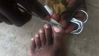 ASMR  Toenail Cutting Art by street barber  Street Pedicure old school technique 100 Sensitivity [upl. by Noirb519]