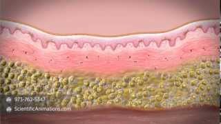 What is stem cell therapy [upl. by Kensell]