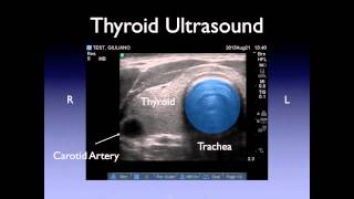 Neck Ultrasound [upl. by Ymmac]