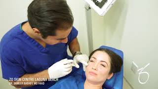 BELOTERO BALANCE® Dermal Filler for Under Eye at ZO Skin Centre [upl. by Dodi11]