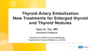 Thyroid Artery Embolization New treatments for enlarged thyroid and thyroid nodules  UCLA Health [upl. by Salokin326]