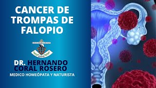 CANCER DE TROMPAS DE FALOPIO [upl. by Odranoel]