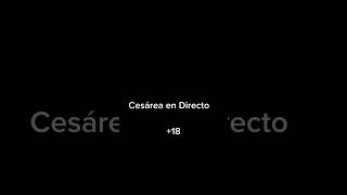 Como hacer una Cesárea en 1miinuto 😱 [upl. by Rodd]