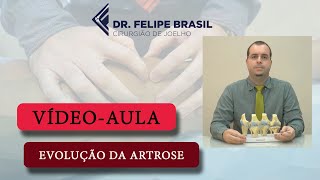 VÍDEO AULA  ARTROSE DO JOELHO [upl. by Pisarik484]