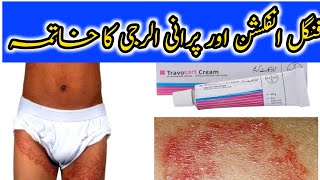 Travocort Cream Uses Benifits and Side Effects In Urdu Used For Fungnal InfectionDr Ijaz Malik [upl. by Azeria954]