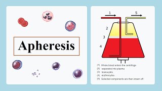 apheresis [upl. by Sancha633]